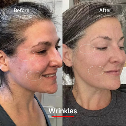 LED Red Light Therapy Face Mask