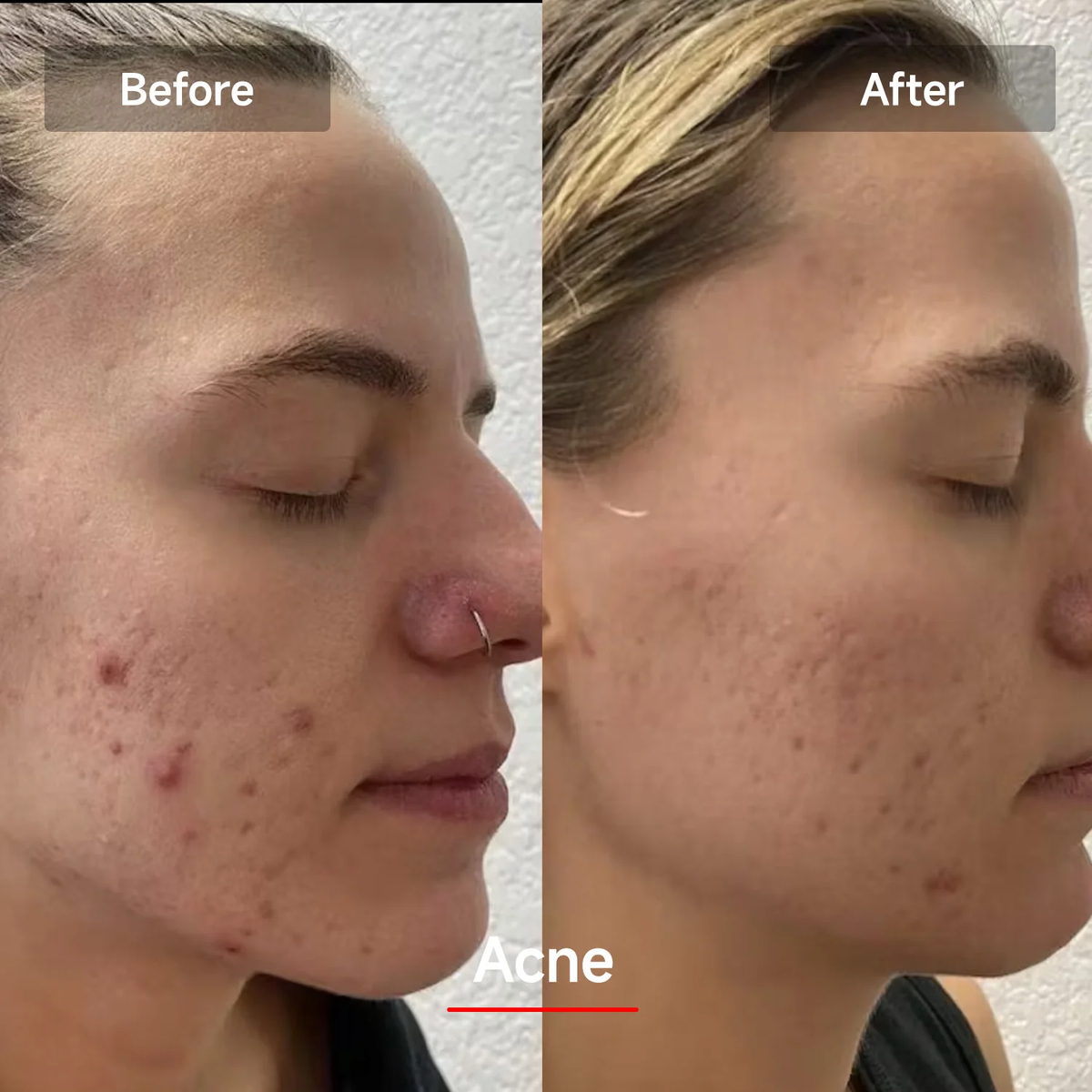 LED Red Light Therapy Face Mask