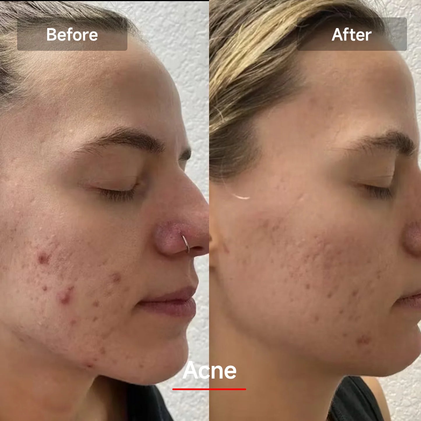 LED Red Light Therapy Face Mask